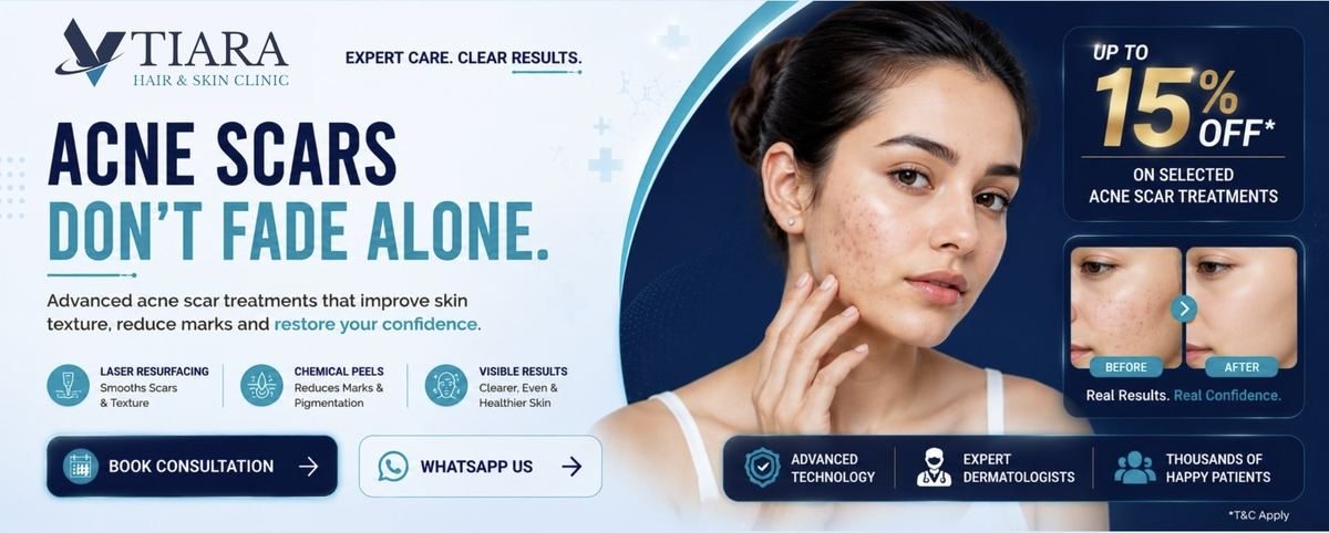 Acne Scars Don't Fade Alone – Acne Scar Treatment in Bangalore at VTIARA
