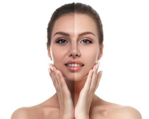 Skin Lightening Treatment in Bangalore - VTIARA Clinic