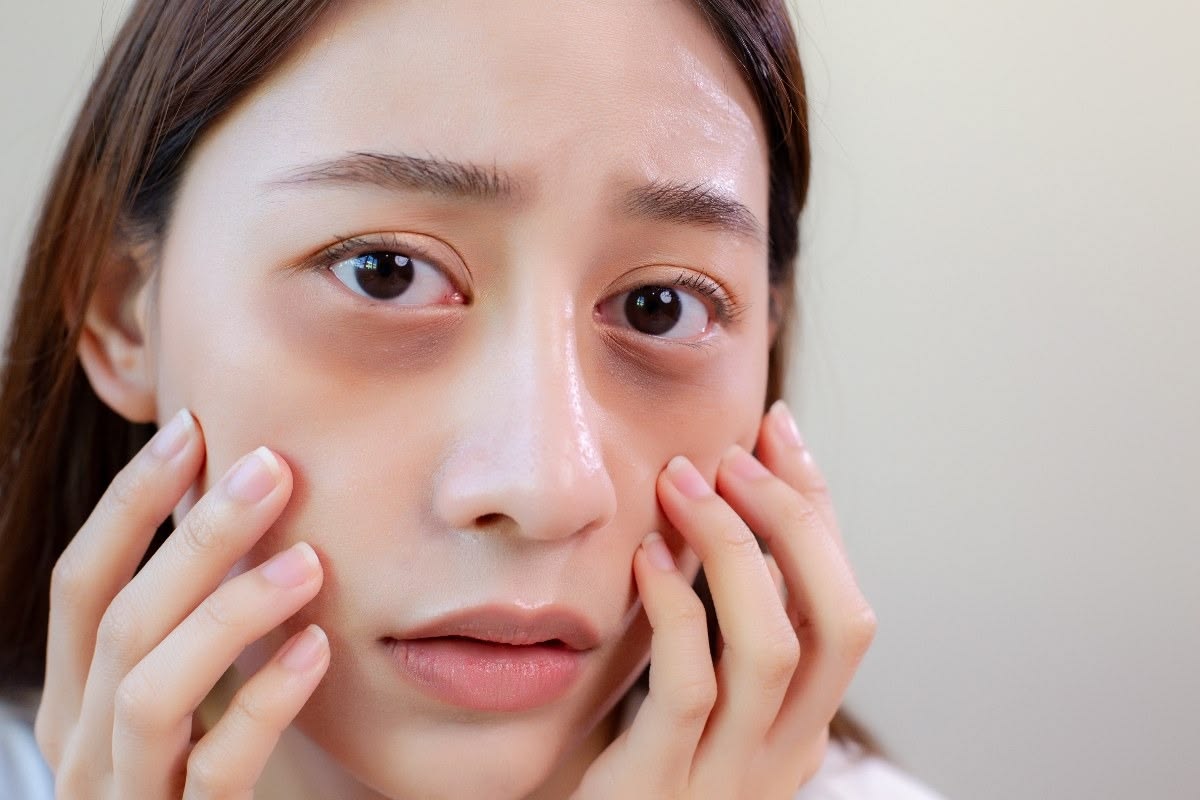 Dark Circle Treatment in Bangalore - VTIARA Clinic