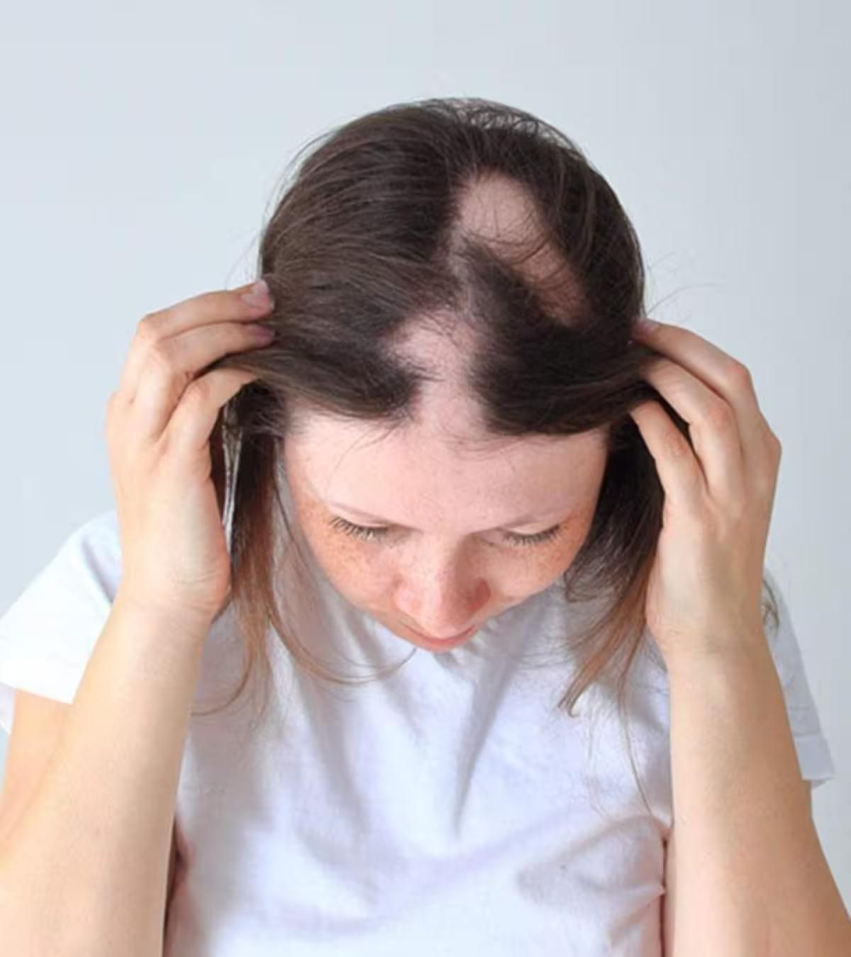 Hair Loss Treatment in Bangalore - VTIARA Clinic