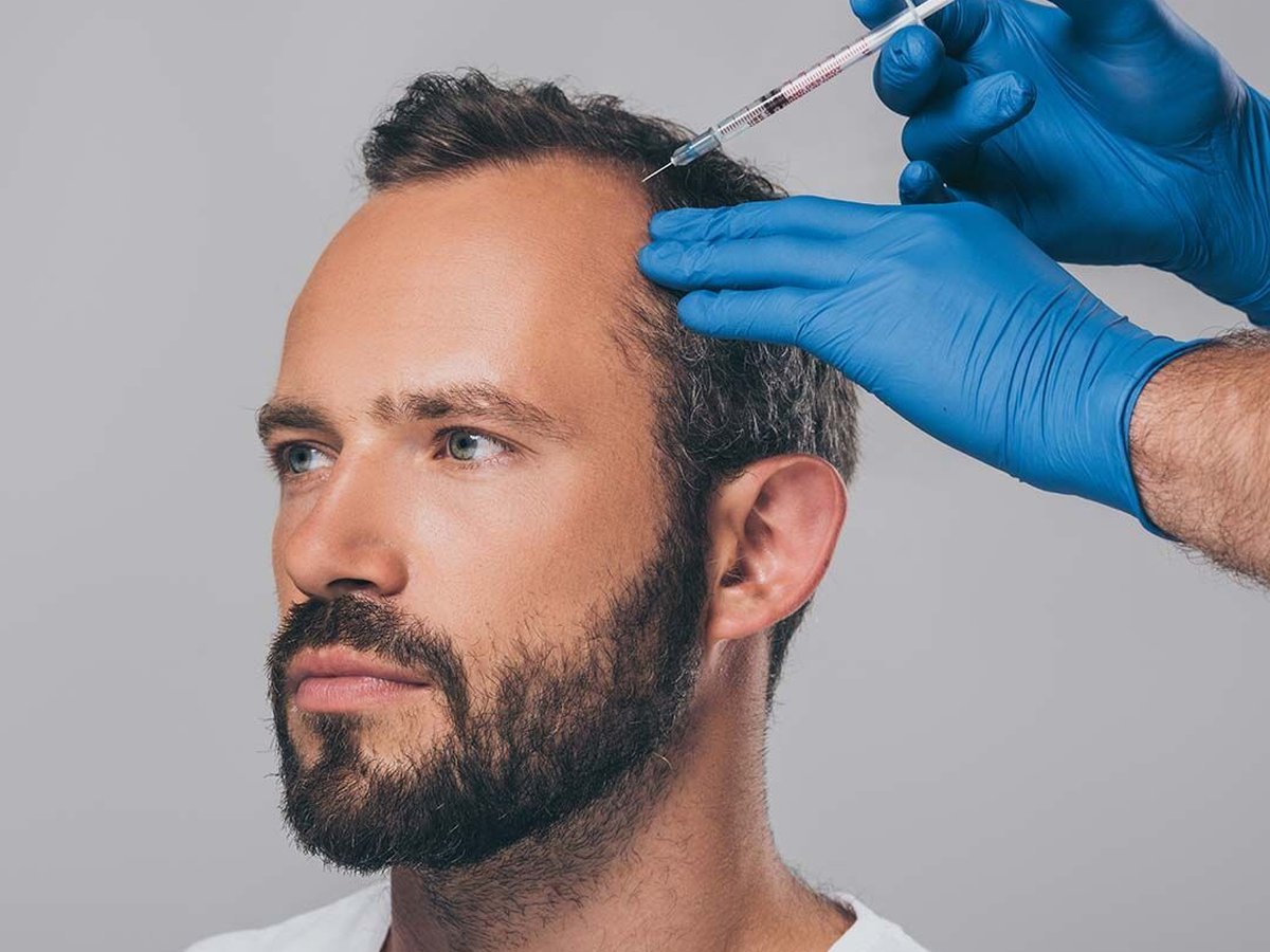 PRP Hair Treatment in Bangalore - VTIARA Clinic