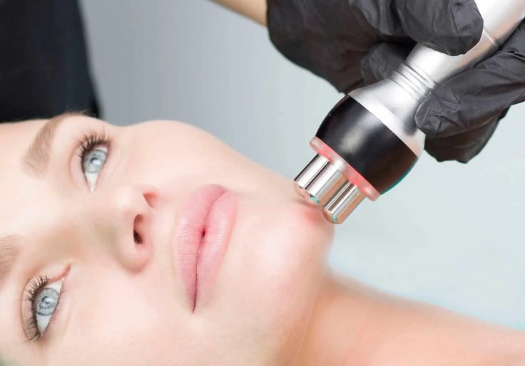 Skin Tightening in Bangalore - VTIARA Clinic